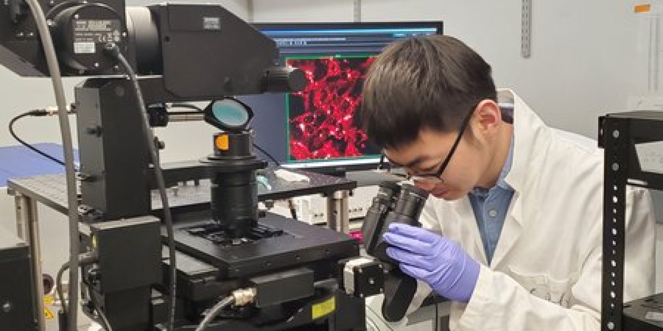 Jiajun Du, étudiante de troisième cycle, prend une image de microscopie à diffusion Raman stimulée de cellules cancéreuses de mélanome en laboratoire.
Crédits : Caltech